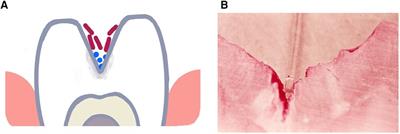 Oral microbial interactions from an ecological perspective: a narrative review
